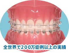 全世界で２００万症例以上の実績